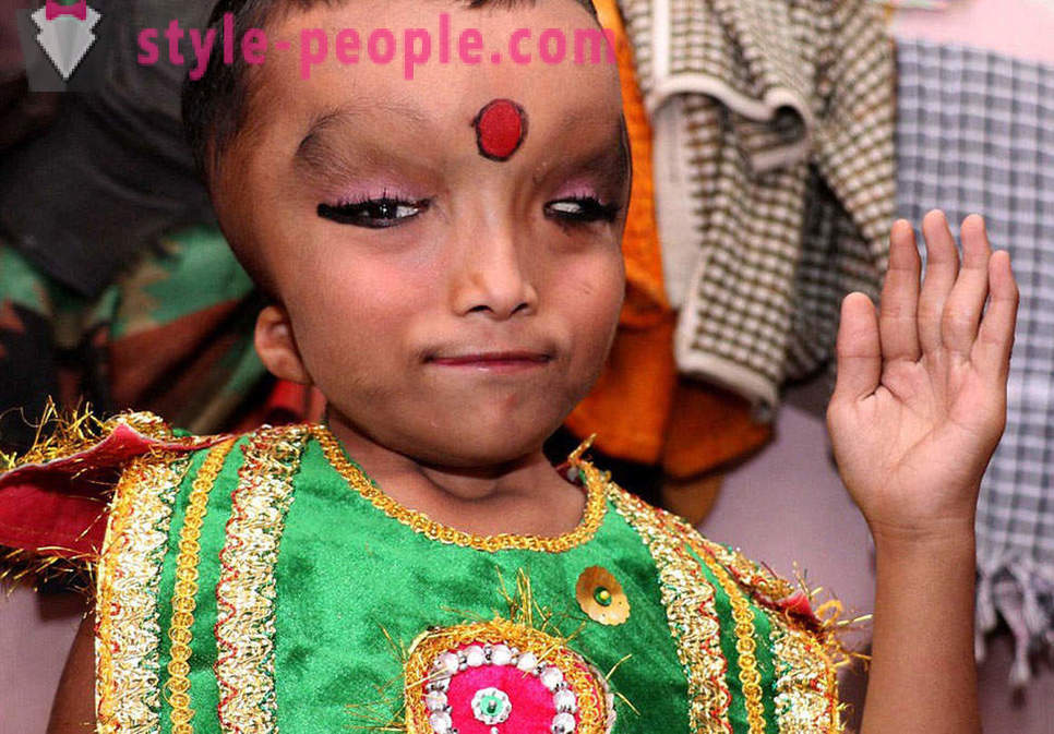 Il villaggio indiano è adorato ragazzo con una testa deformata come un dio Ganesha
