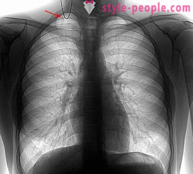 10 fatti strani e inaspettati sugli organi del corpo umano