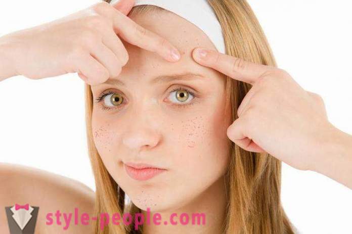 Maschere di acne a casa. maschera efficace per l'acne
