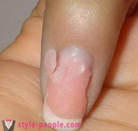 Come rimuovere le unghie acriliche a casa? Rimozione unghie acriliche: recensioni